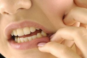 Diş Gıcırdatma ve Tedavi Yöntemleri
