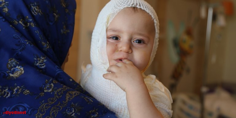Erzincan'da üzerine kaynar süt dökülen minik Yusuf Erzurum'da tedaviye alındı