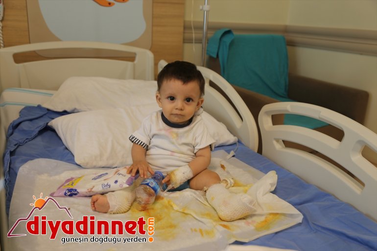 Ağrı'da üzerine kaynar su dolu çaydanlık devrilen bebek Erzurum'da tedaviye alındı