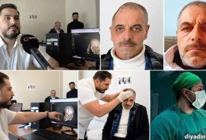Ağrı'da ilk kez yapıldı: 63 yaşındaki hasta sentetik kafatası ameliyatıyla sağlığına kavuştu