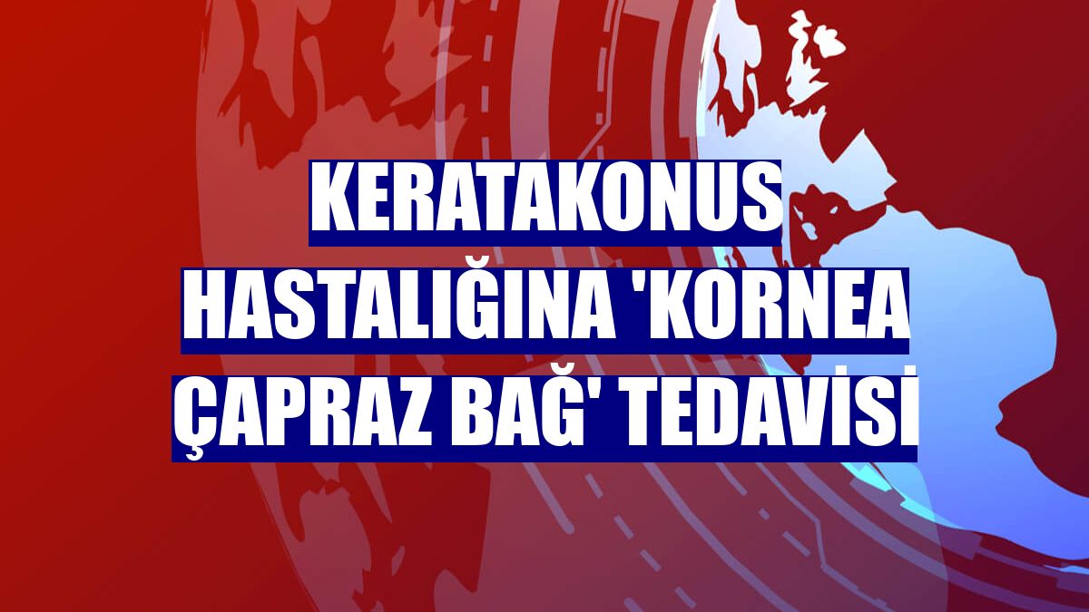 Keratakonus hastalığına 'kornea çapraz bağ' tedavisi