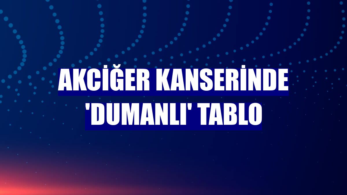 Akciğer kanserinde 'dumanlı' tablo