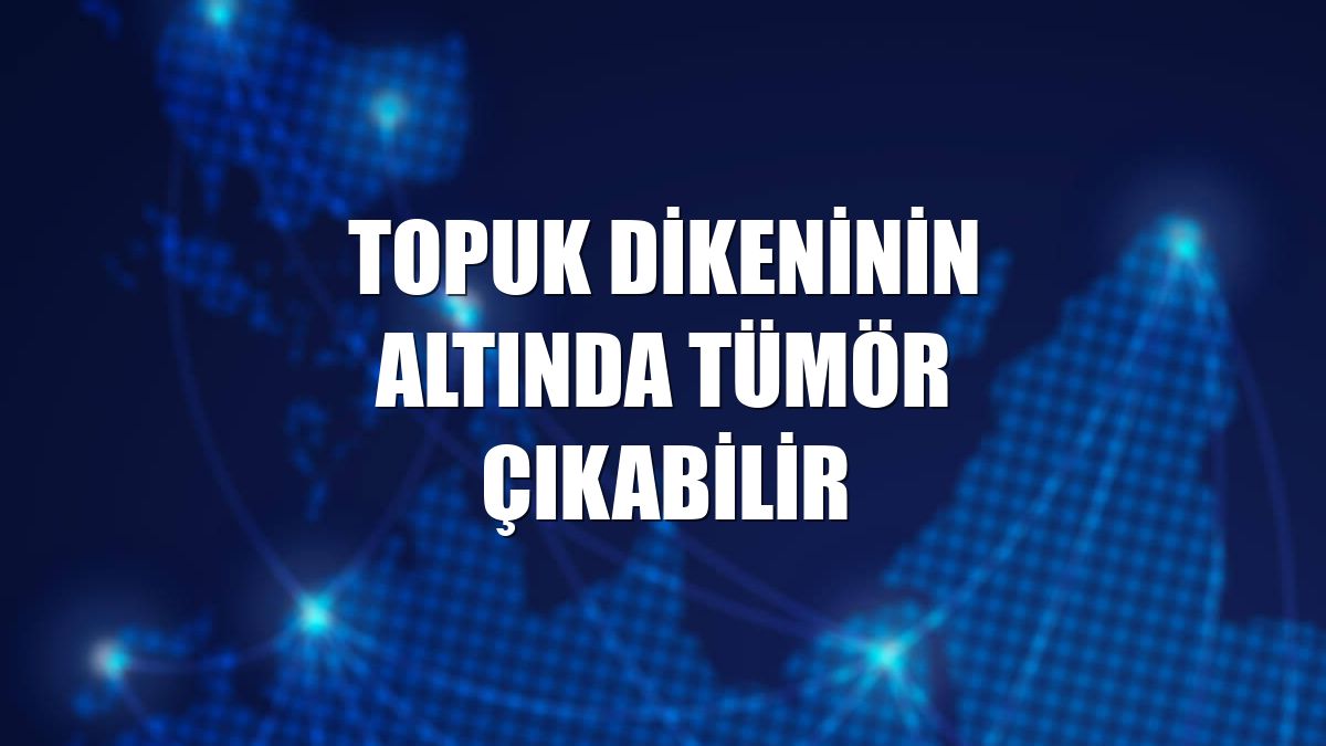 Topuk dikeninin altında tümör çıkabilir