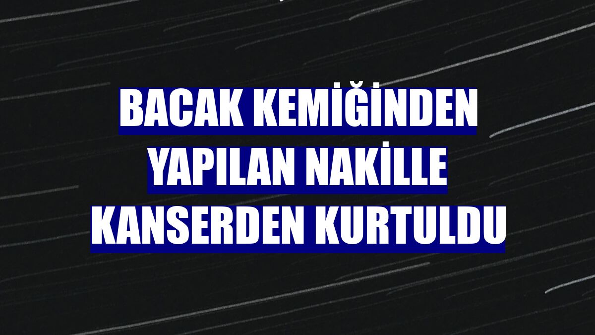 Bacak kemiğinden yapılan nakille kanserden kurtuldu