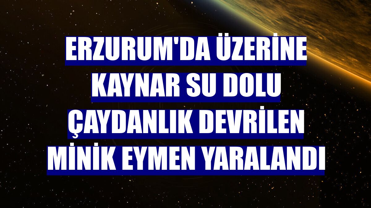 Erzurum'da üzerine kaynar su dolu çaydanlık devrilen minik Eymen yaralandı
