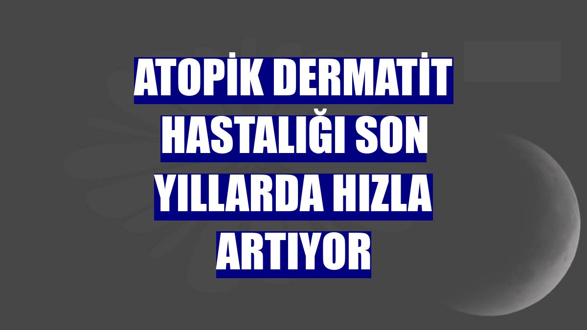Atopik Dermatit hastalığı son yıllarda hızla artıyor