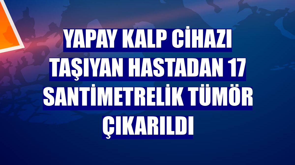 Yapay kalp cihazı taşıyan hastadan 17 santimetrelik tümör çıkarıldı