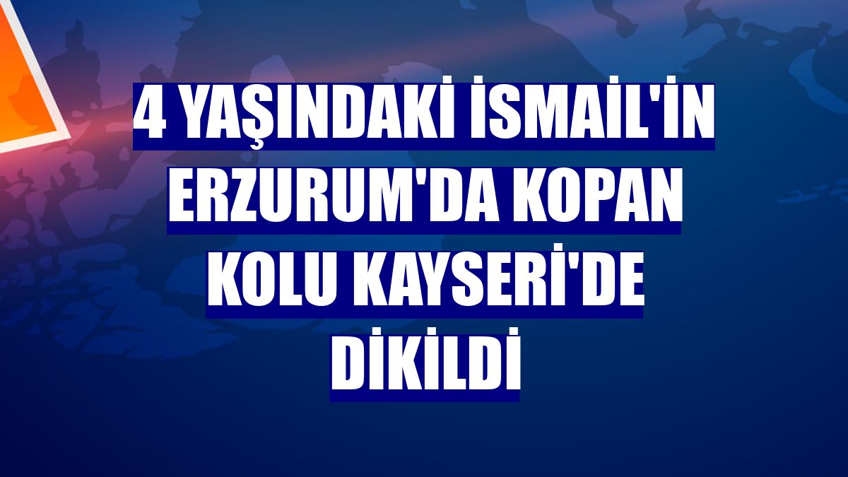 4 yaşındaki İsmail'in Erzurum'da kopan kolu Kayseri'de dikildi