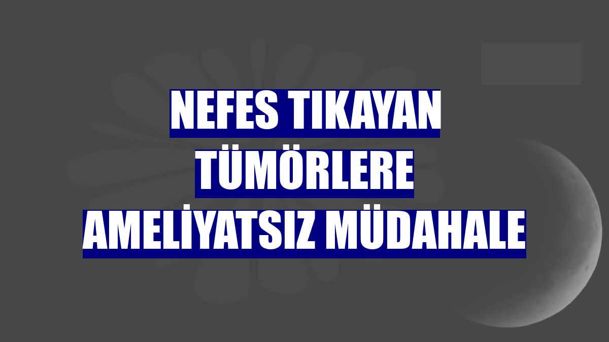 Nefes tıkayan tümörlere ameliyatsız müdahale