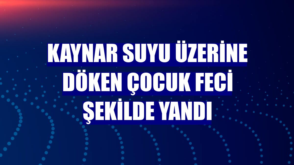 Kaynar suyu üzerine döken çocuk feci şekilde yandı