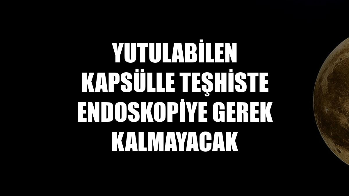 Yutulabilen kapsülle teşhiste endoskopiye gerek kalmayacak