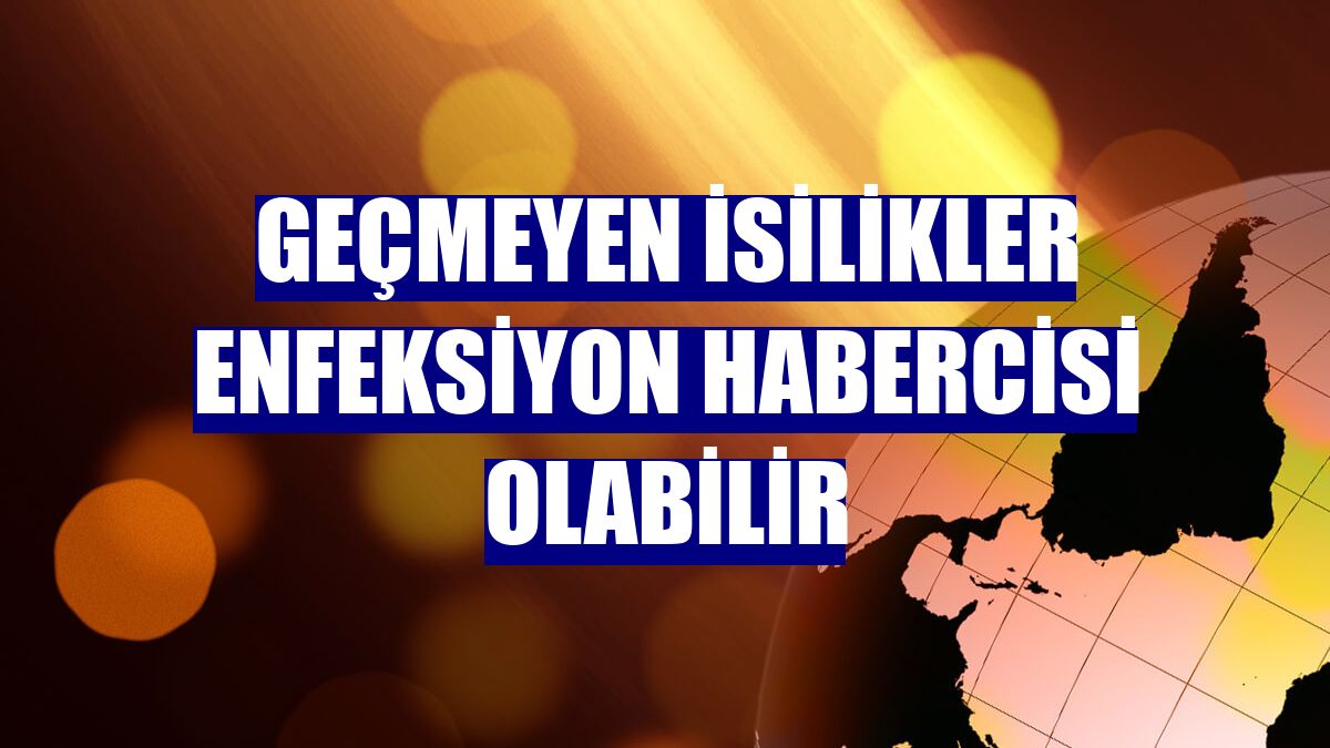 Geçmeyen isilikler enfeksiyon habercisi olabilir