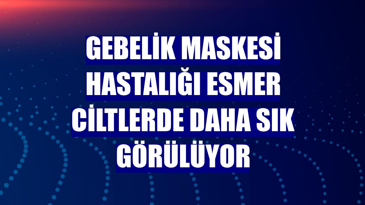 Gebelik maskesi hastalığı esmer ciltlerde daha sık görülüyor