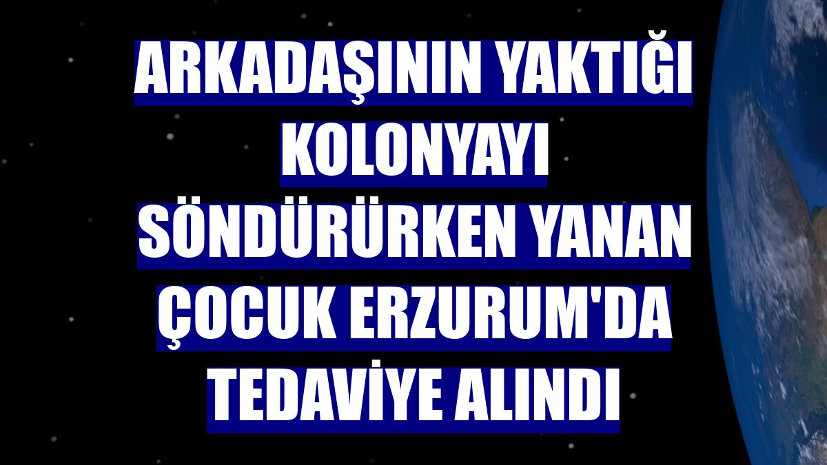 Arkadaşının yaktığı kolonyayı söndürürken yanan çocuk Erzurum'da tedaviye alındı