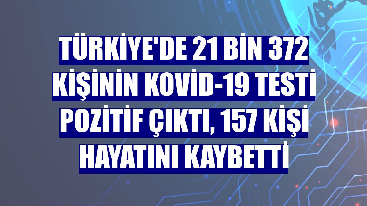 Türkiye'de 21 bin 372 kişinin Kovid-19 testi pozitif çıktı, 157 kişi hayatını kaybetti