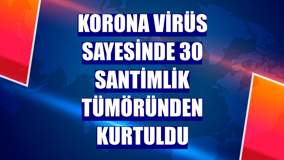 Korona virüs sayesinde 30 santimlik tümöründen kurtuldu