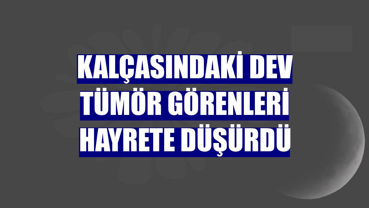Kalçasındaki dev tümör görenleri hayrete düşürdü