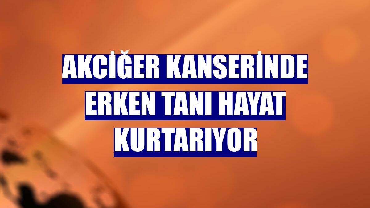 Akciğer kanserinde erken tanı hayat kurtarıyor