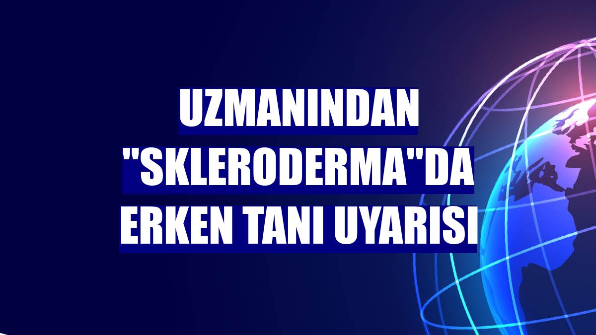 Uzmanından "skleroderma"da erken tanı uyarısı