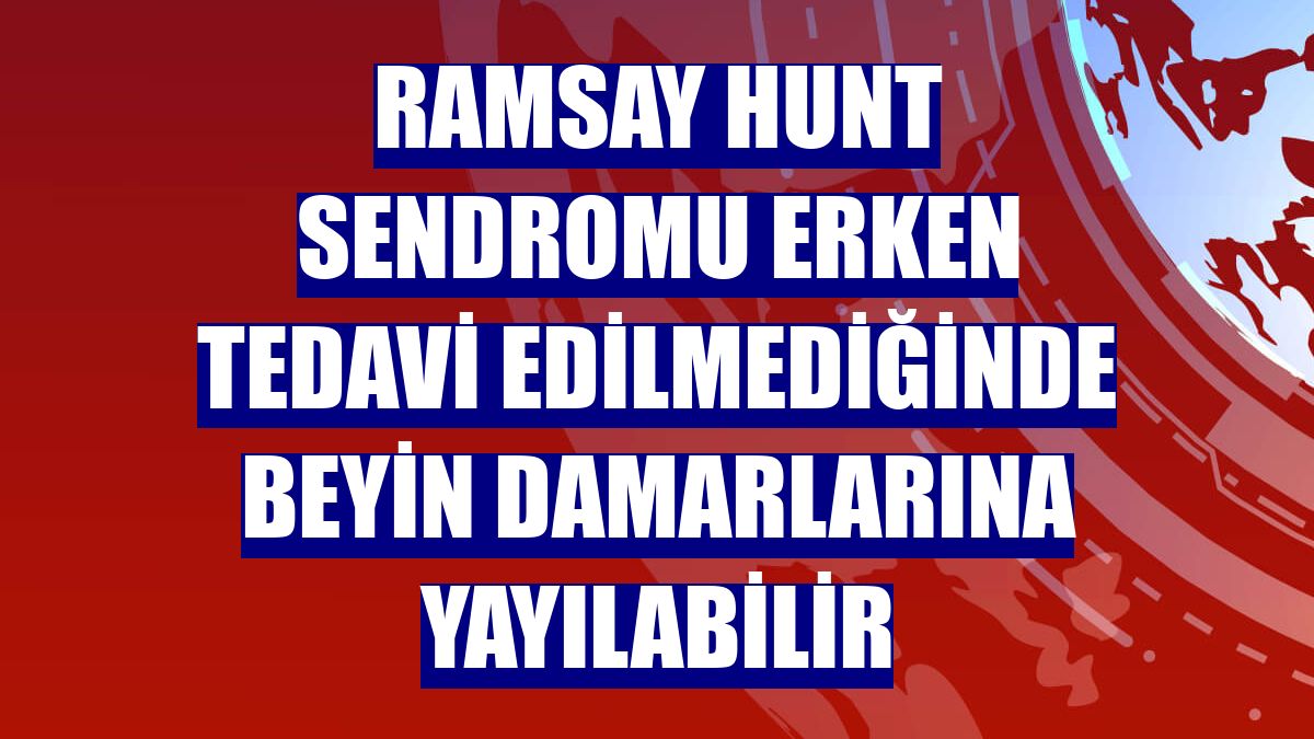Ramsay Hunt sendromu erken tedavi edilmediğinde beyin damarlarına yayılabilir