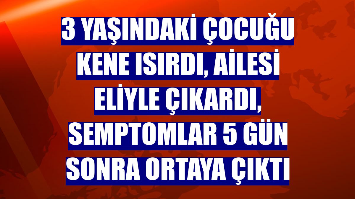 3 yaşındaki çocuğu kene ısırdı, ailesi eliyle çıkardı, semptomlar 5 gün sonra ortaya çıktı
