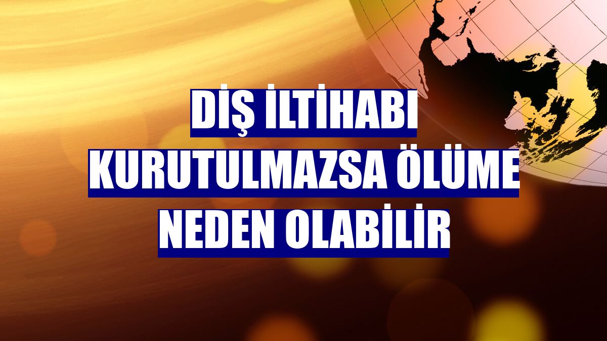 Diş iltihabı kurutulmazsa ölüme neden olabilir