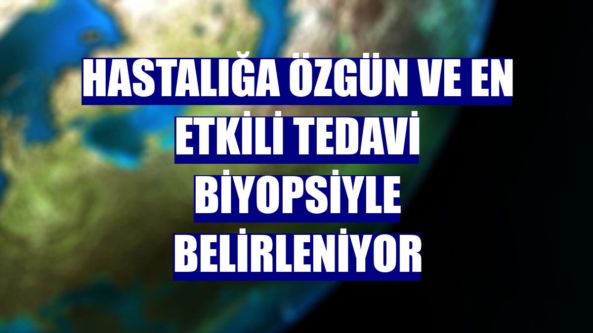 Hastalığa özgün ve en etkili tedavi biyopsiyle belirleniyor