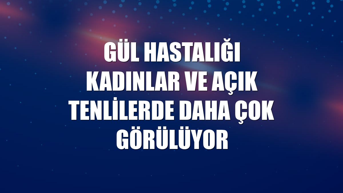 Gül hastalığı kadınlar ve açık tenlilerde daha çok görülüyor