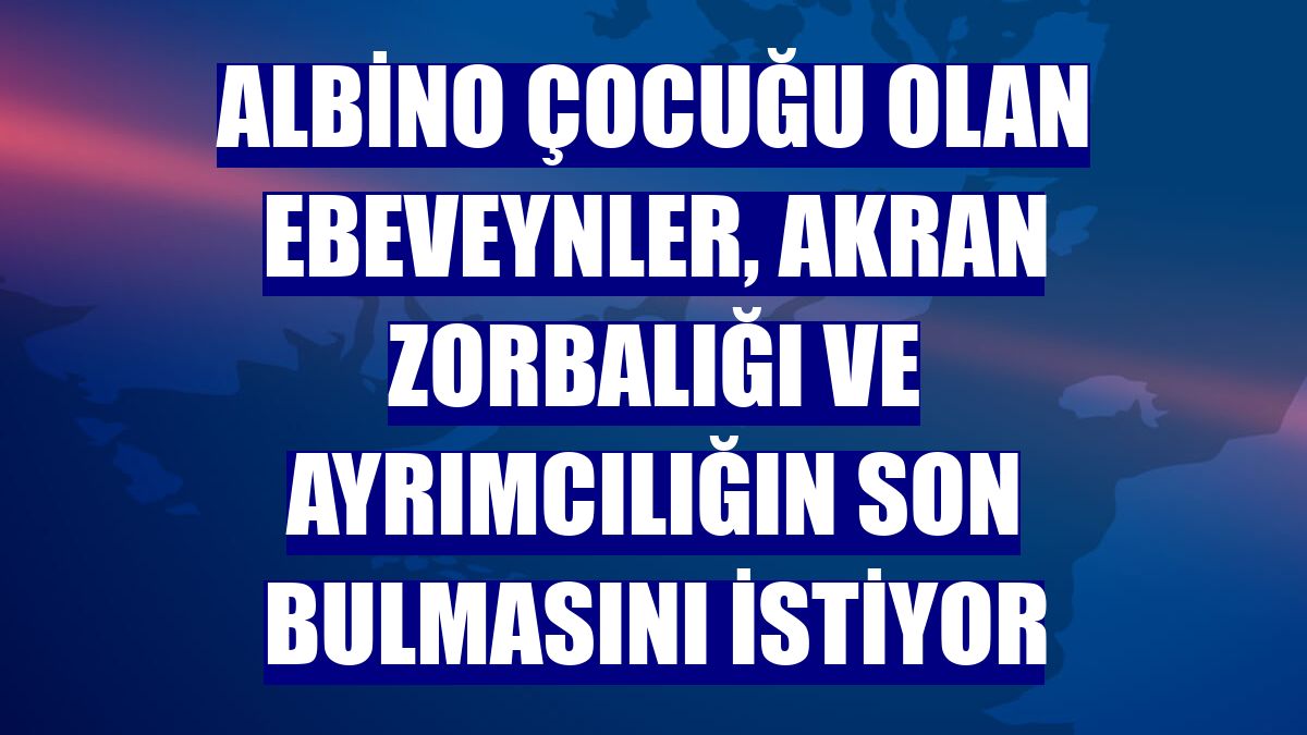 Albino çocuğu olan ebeveynler, akran zorbalığı ve ayrımcılığın son bulmasını istiyor