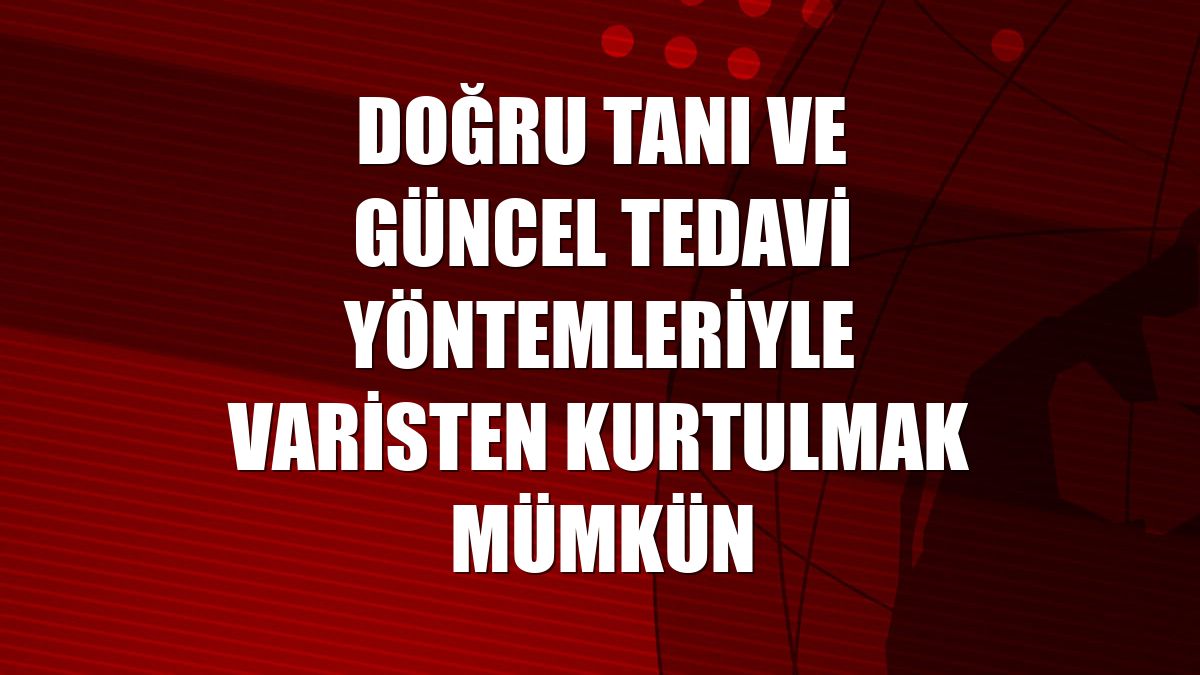 Doğru tanı ve güncel tedavi yöntemleriyle varisten kurtulmak mümkün
