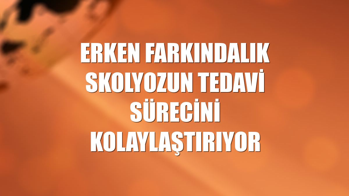 Erken farkındalık skolyozun tedavi sürecini kolaylaştırıyor