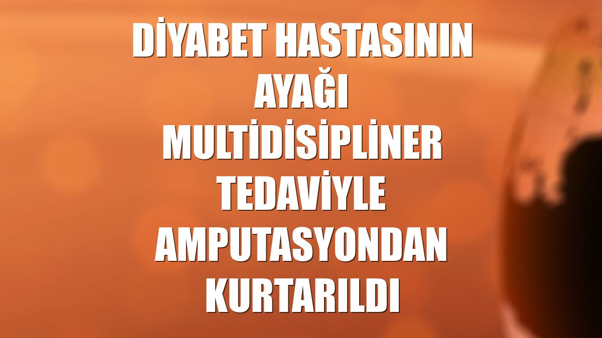 Diyabet hastasının ayağı multidisipliner tedaviyle amputasyondan kurtarıldı