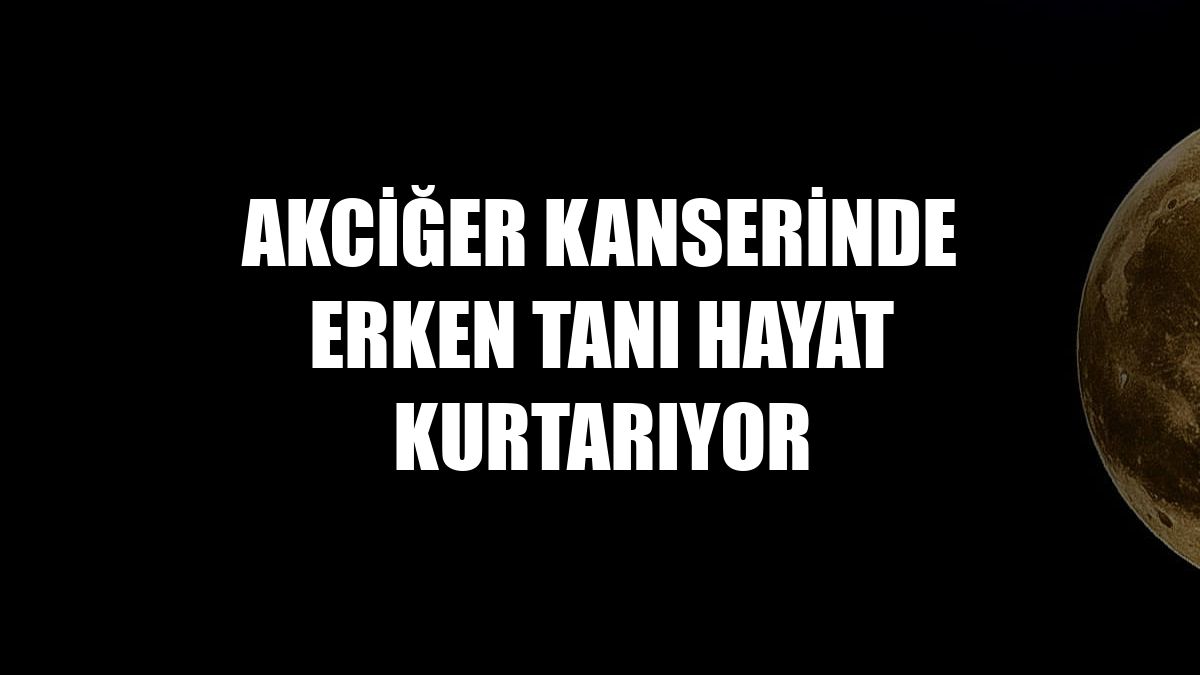 Akciğer kanserinde erken tanı hayat kurtarıyor