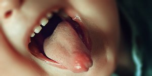 Dil Sağlığını Korumak İçin Neler Yapmalıyız