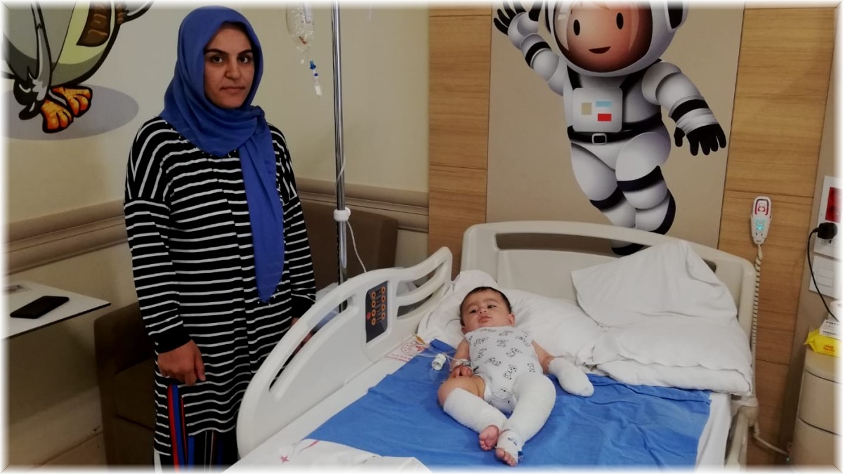 10 aylık bebeğin üzerine çaydanlık devrildi