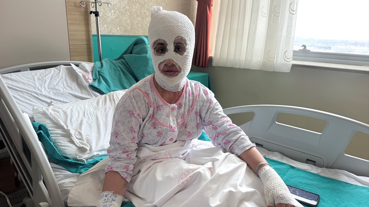 Ağrı’da düdüklü tencere patladı, Genç kadın ağır yaralandı