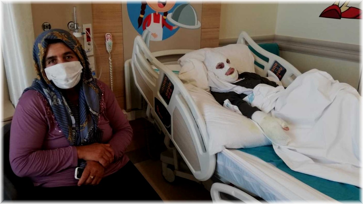 70 yaşındaki kadın tüp patlaması sonucu feci şekilde yandı