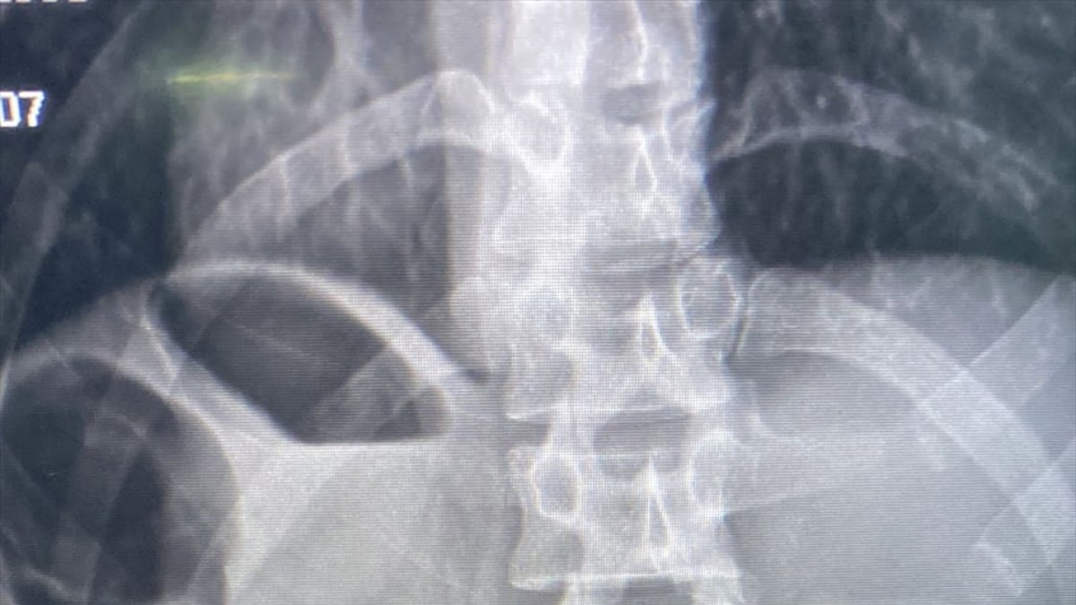 Ağrı'da vücudunda uyuşturucu taşıyan İranlı tutuklandı