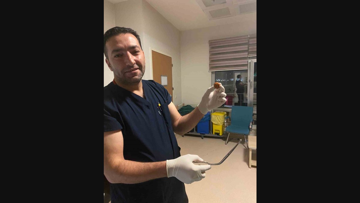 Ağrı'da yuttuğu ceviz yemek borusundan çıkarıldı