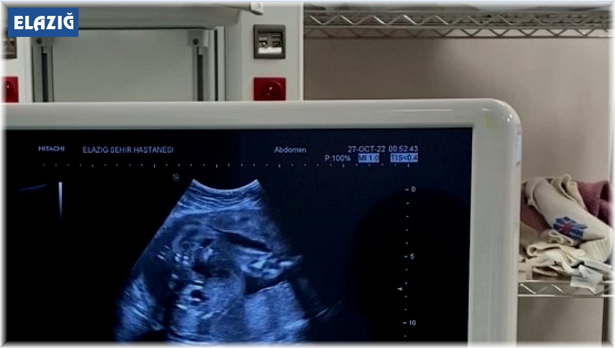 Anne karnındaki bebeğe stent takıldı