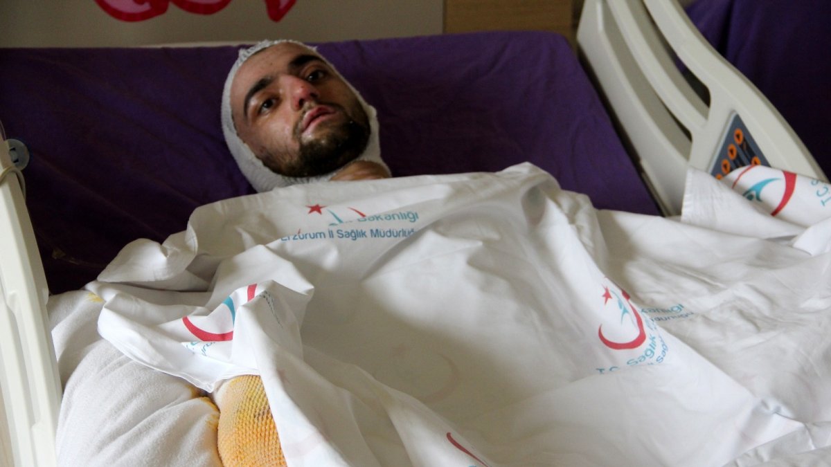 Banyo yapmak için sobaya benzin döktü, feci şekilde yandı