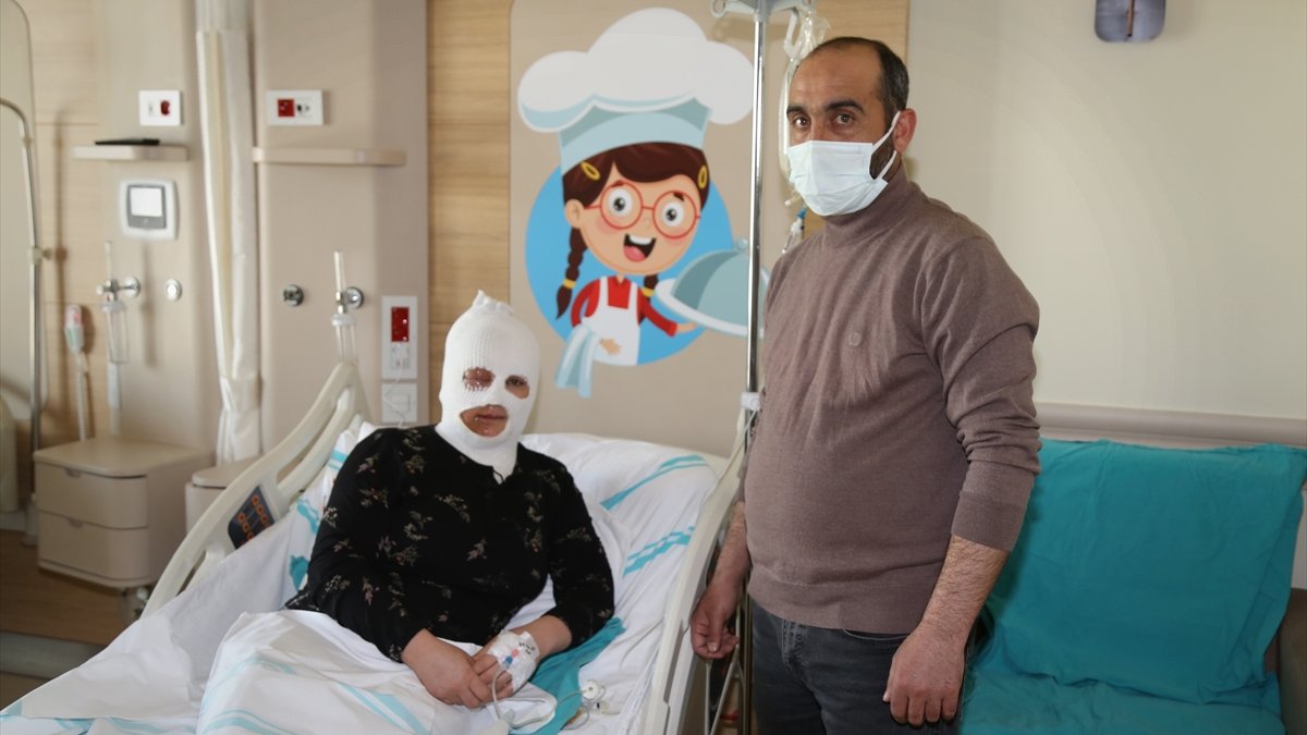 Bayburt'ta üzerine kaynar su dökülen kadın Erzurum'da tedaviye alındı