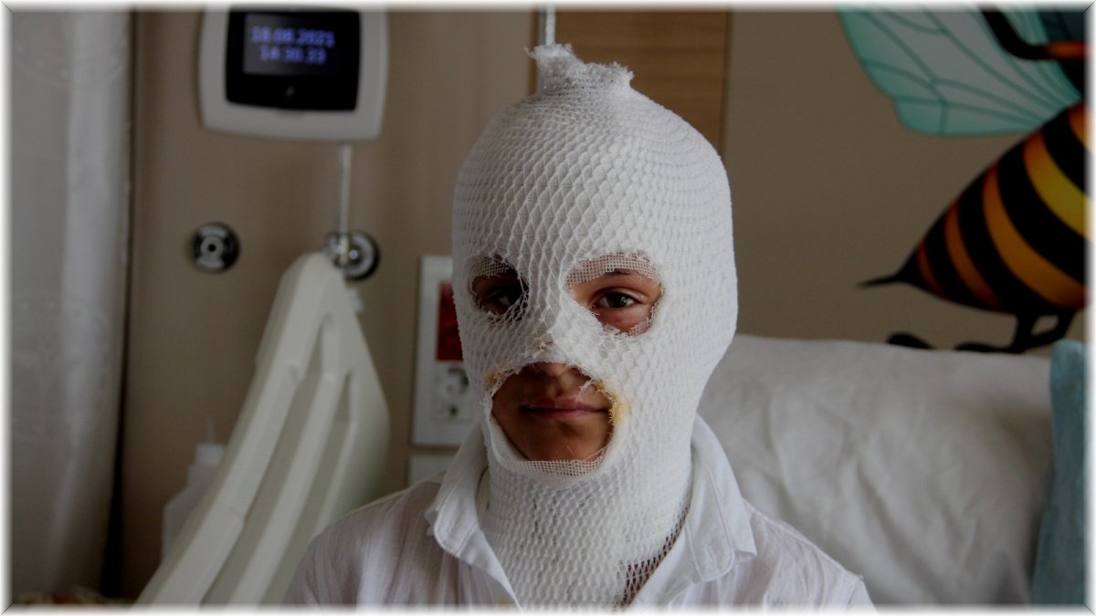 Camide çıkan yangını söndürmeye çalışırken kendisi yandı