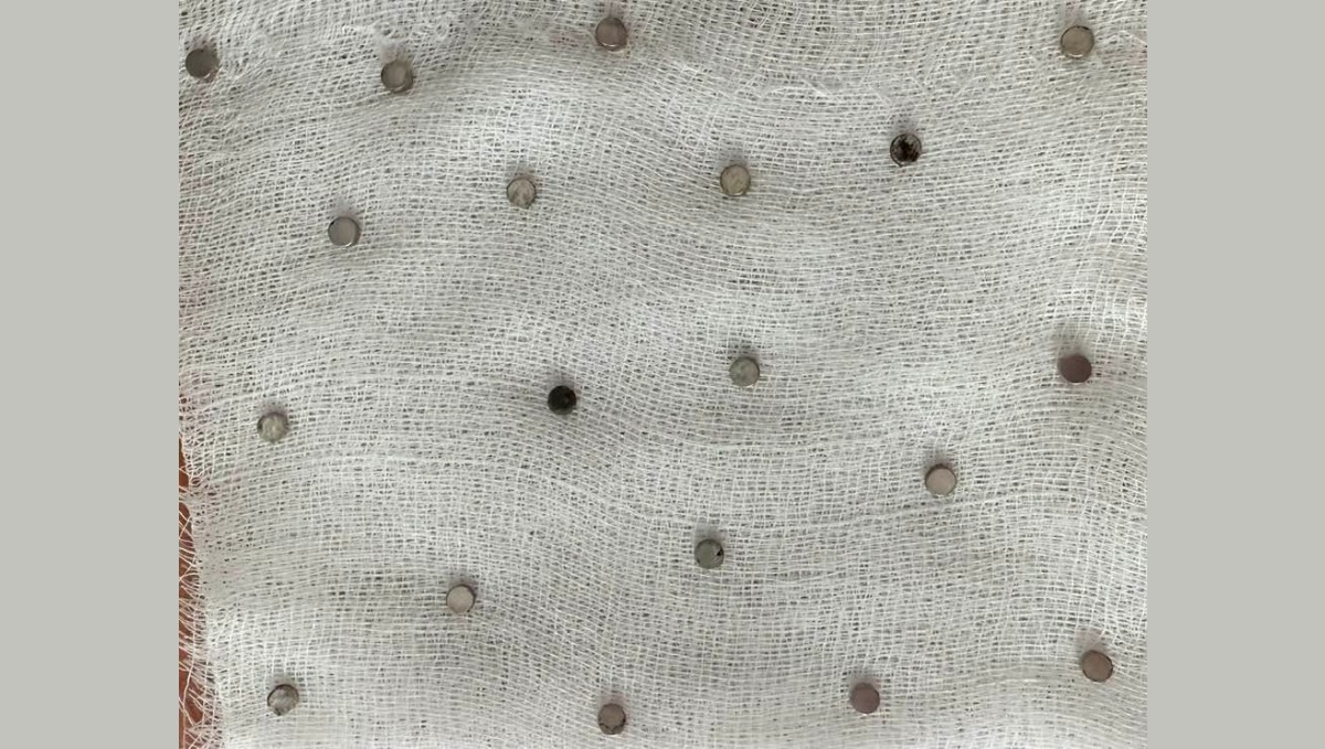 Çocuğun boğazından 19 adet mıknatıs çıkartıldı