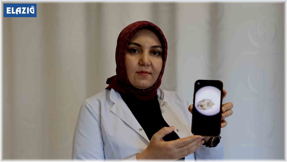 Dermatoloji Uzmanı Dr. Gürok: "2018 yılından sonra uyuz vakasında ciddi bir artış vardı"