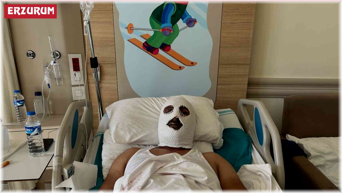 Doğal gaz borusunu tamir etmek için gitti felaketi yaşadı