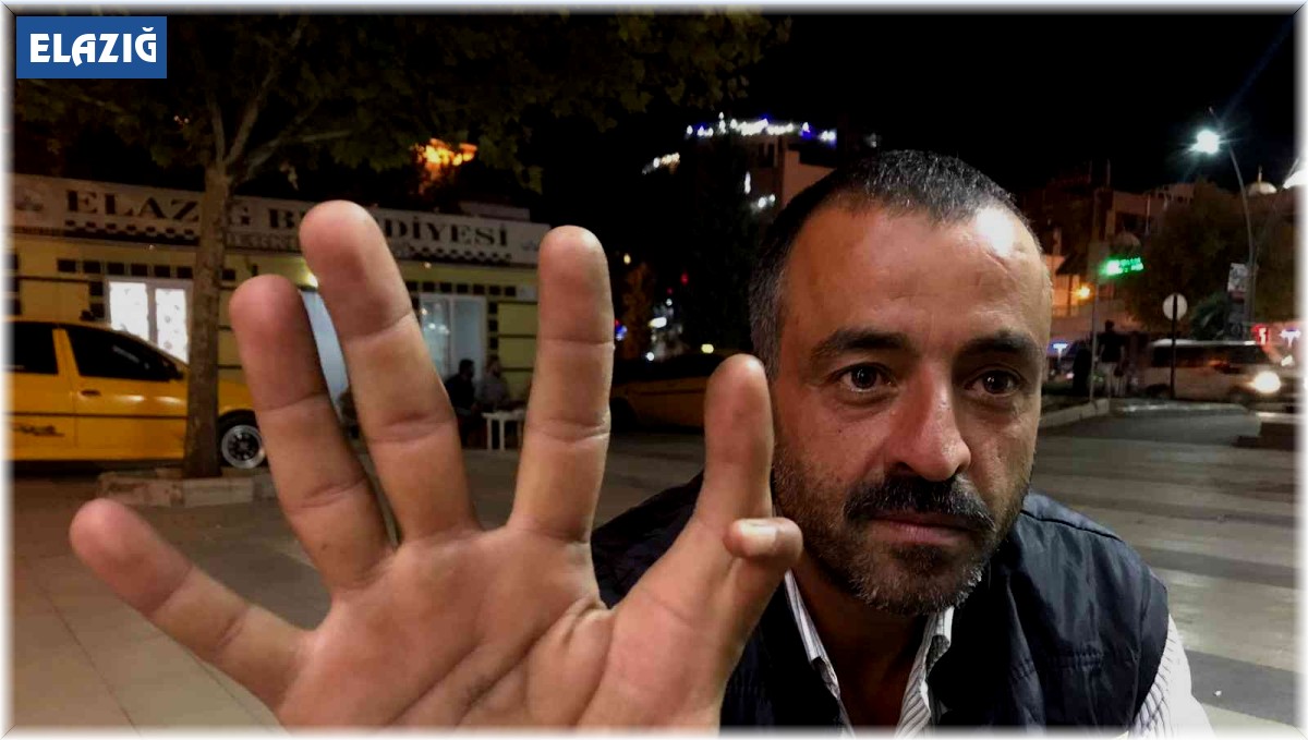 Elazığ'da 11 parmaklı adam görenleri hayrete düşürüyor