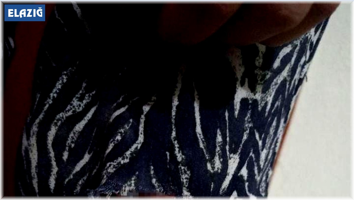 Elazığ'da başıboş köpeklerin kovaladığı şahıs yaralandı