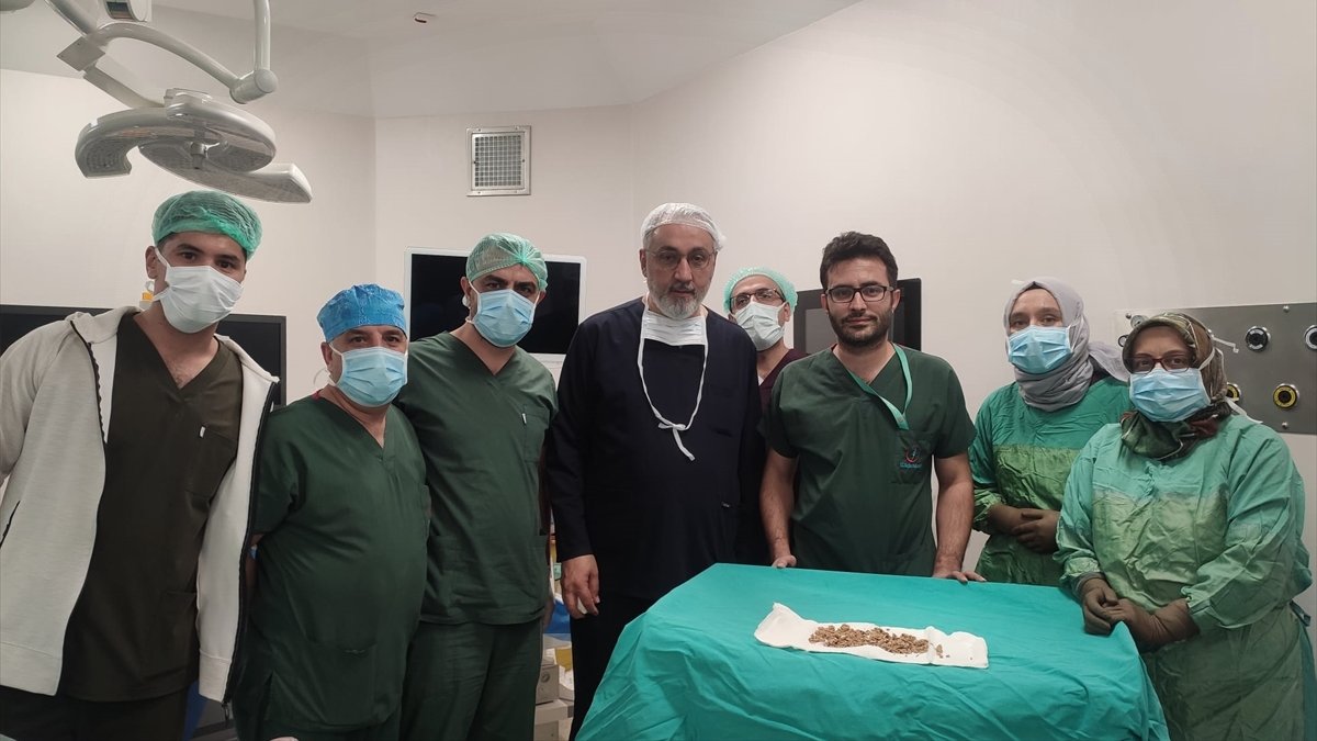 Elazığ'da bir hastanın böbreğindeki 13 santimetrelik taş kapalı ameliyatla çıkarıldı