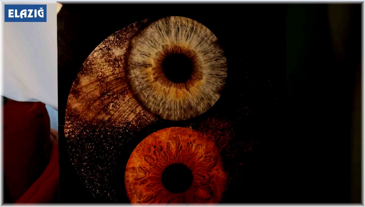 Elazığ'da 'gözler' sanata dönüşüyor